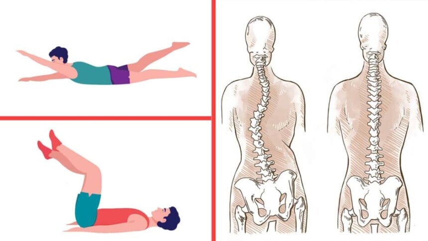 4 Exercises for People with Scoliosis