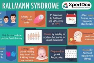 Clinical presentation of Kallmann syndrome