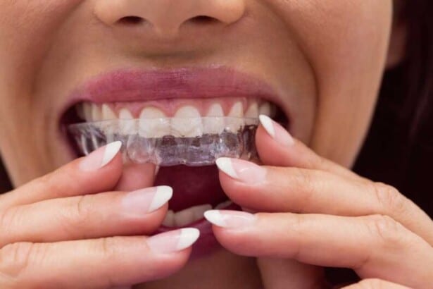 female patient wearing braces