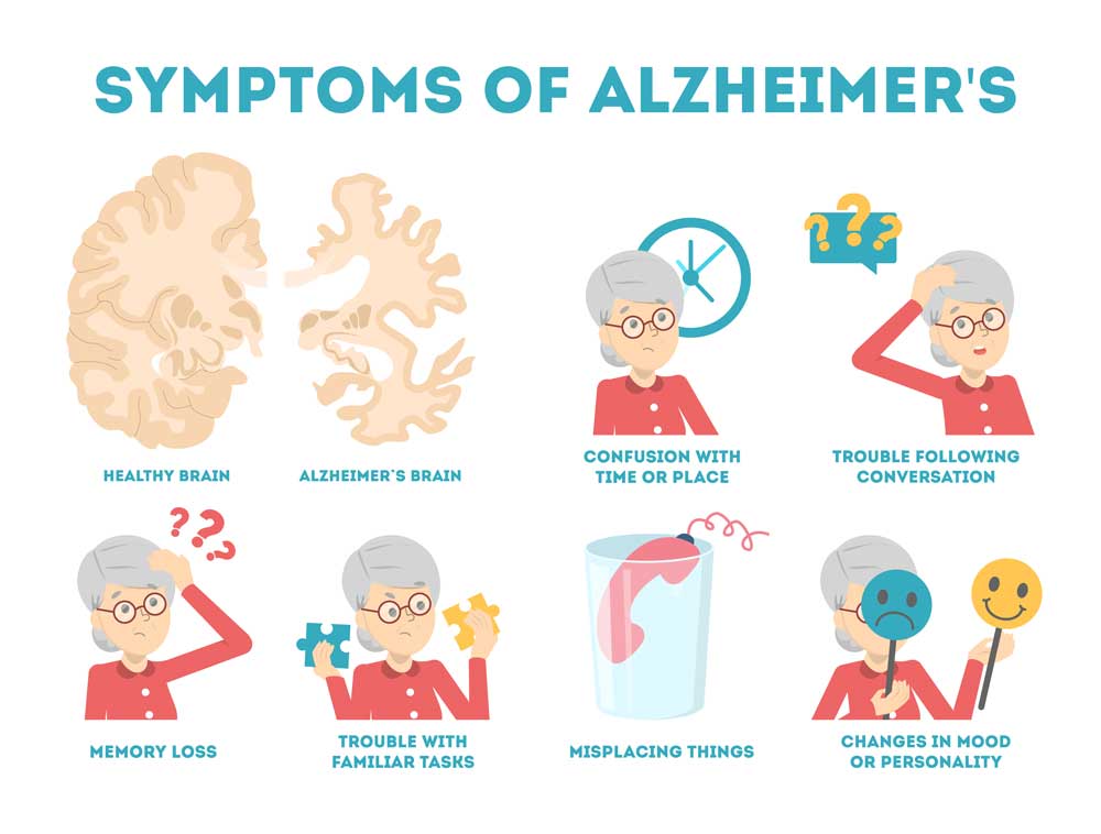 Alzheimer disease symptoms infographic